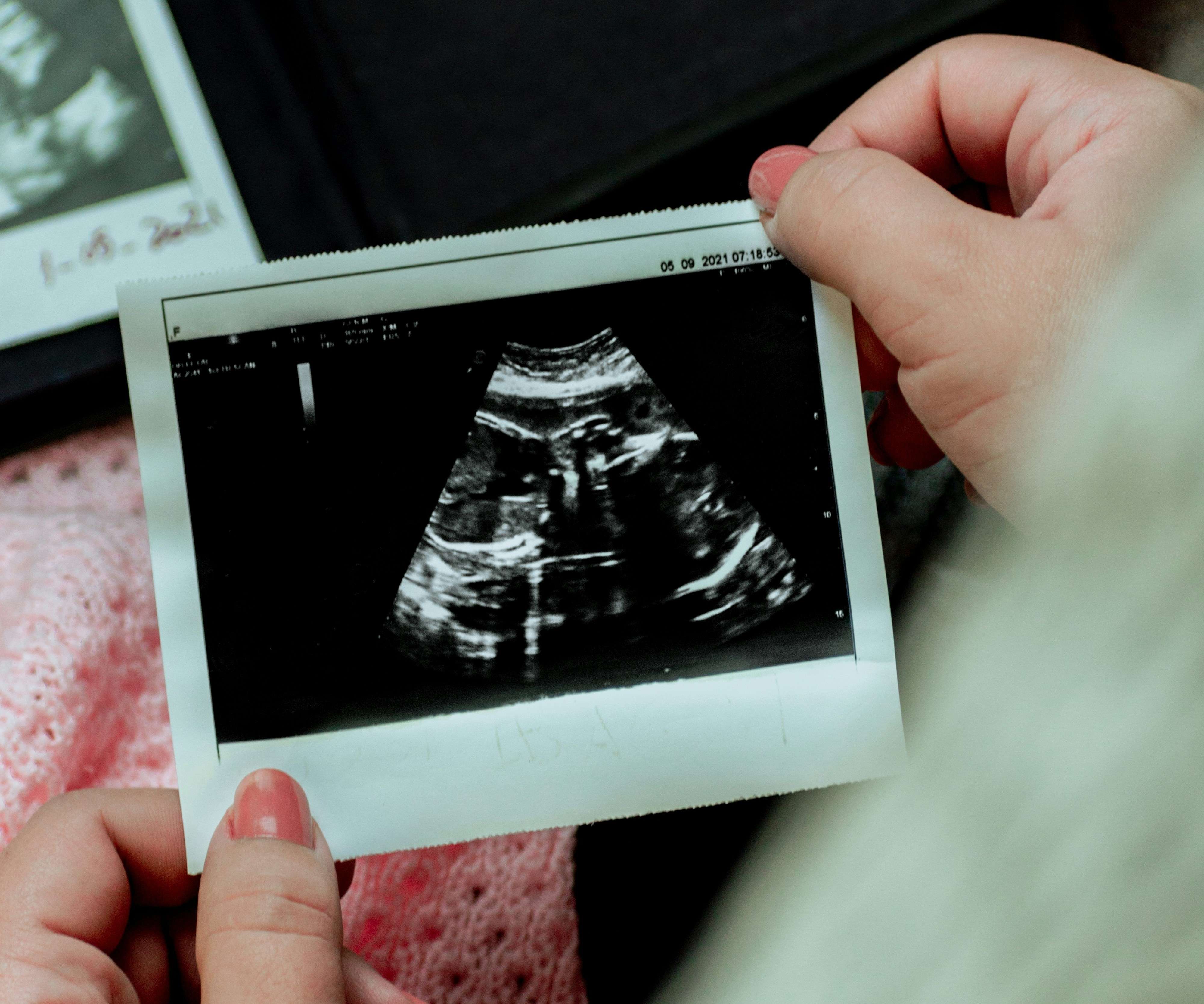 Could this tragedy have been prevented with pregnancy help?