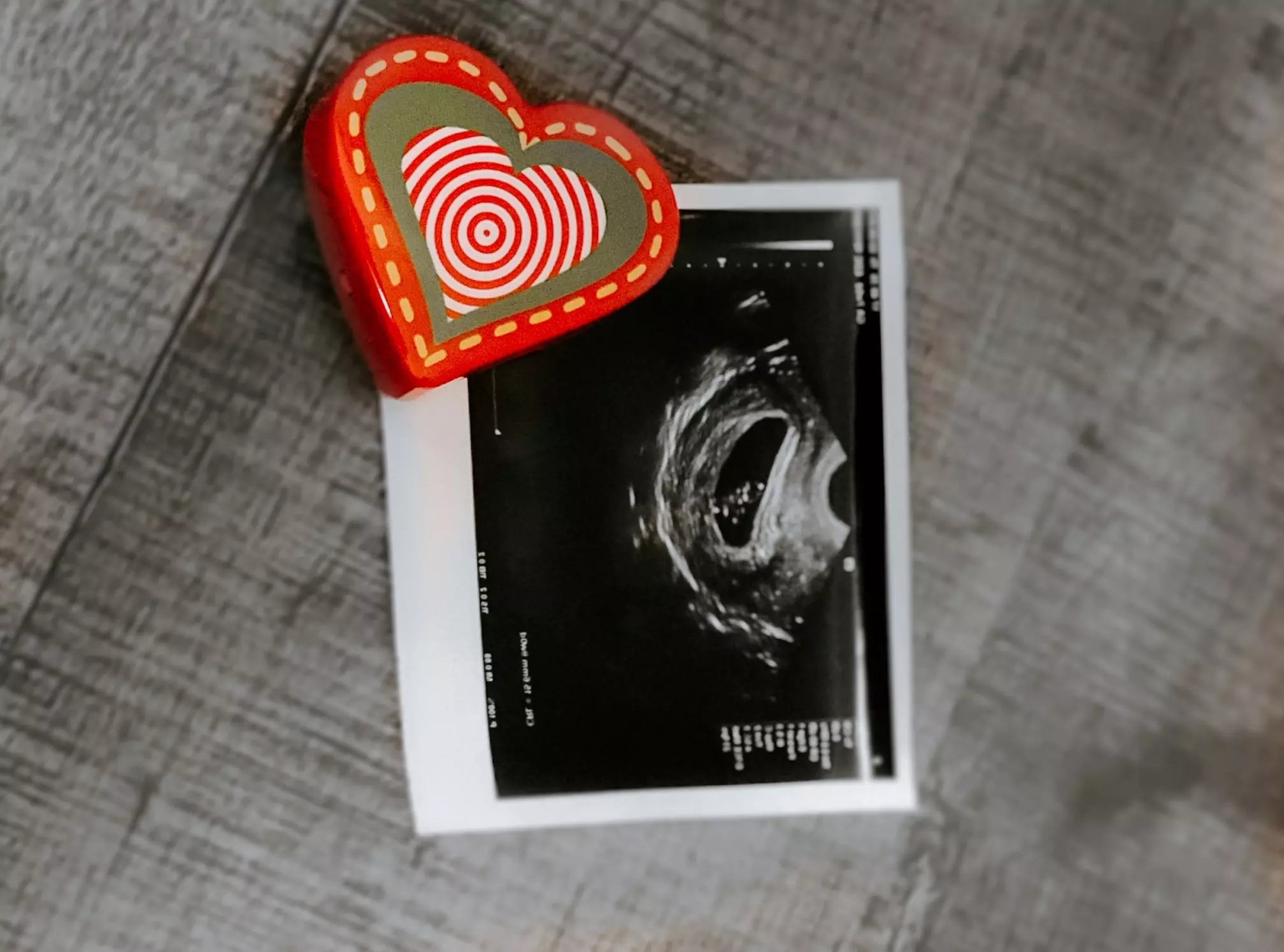 Abortion stops a beating heart \"even early in pregnancy\" - SFLA takes the truth to U.S. campuses