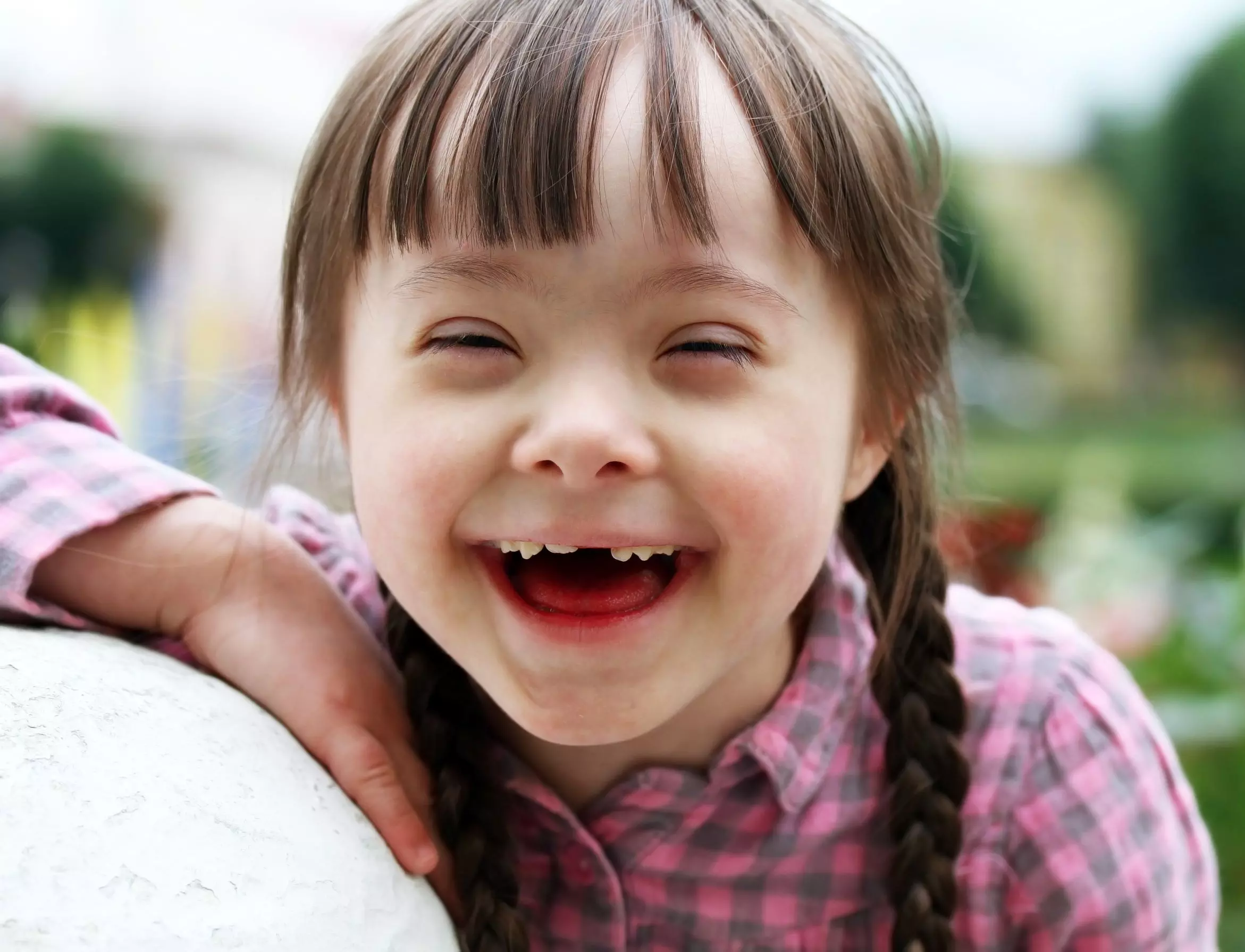 Babies with Down Syndrome Deserve Love, Not Eradication