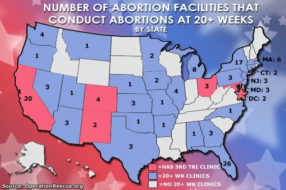 Disturbing trend: More abortion clinics moving into the late-term abortion business