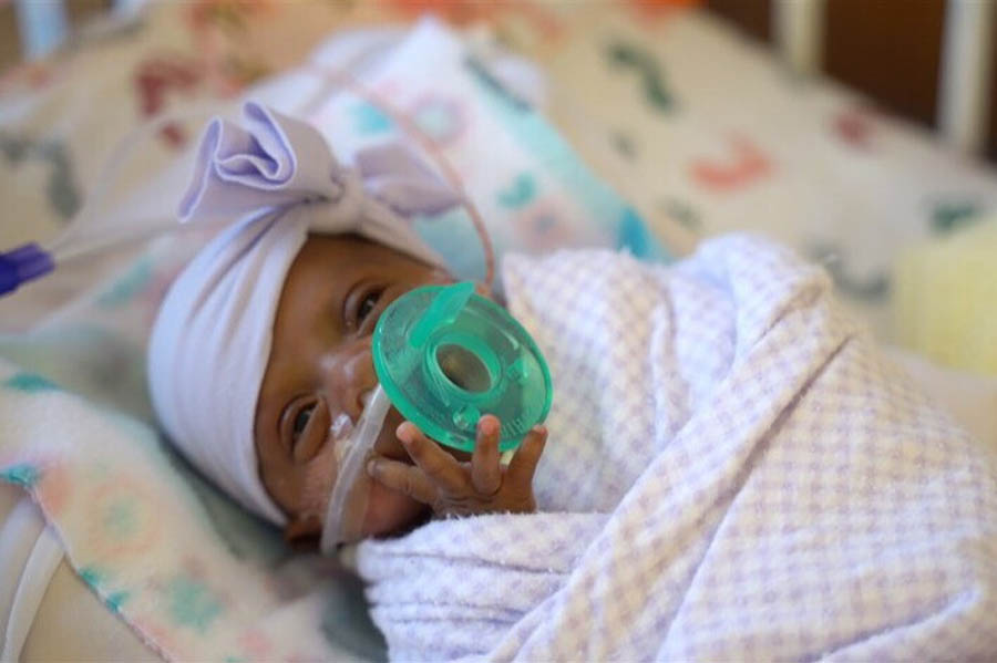 Nicknamed "Saybie" by her doctors, this little girl is believed to be the smallest surviving premature baby in the world.