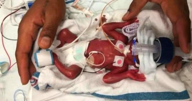 Preemie born a week before the UK abortion limit has just celebrated his first birthday