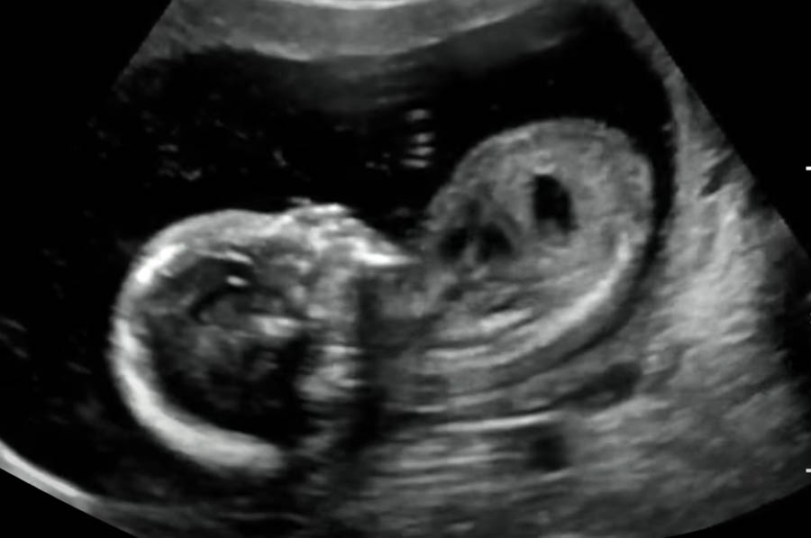 Inside a pregnancy center that pro-abortion vandals attacked