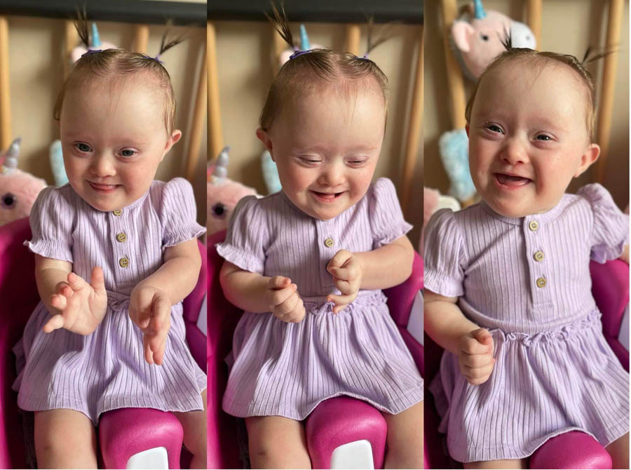 “Down syndrome is not a death sentence”- Parents reject doctor-scheduled abortion