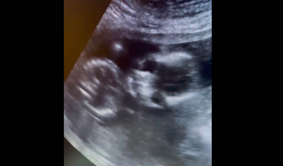 Houston pregnancy help center steps into the breach for migrant girls