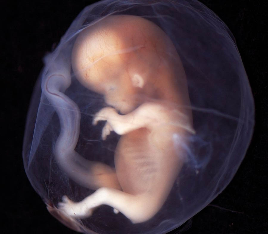 The Guardian is wrong: this is what a 9-week old unborn baby looks like
