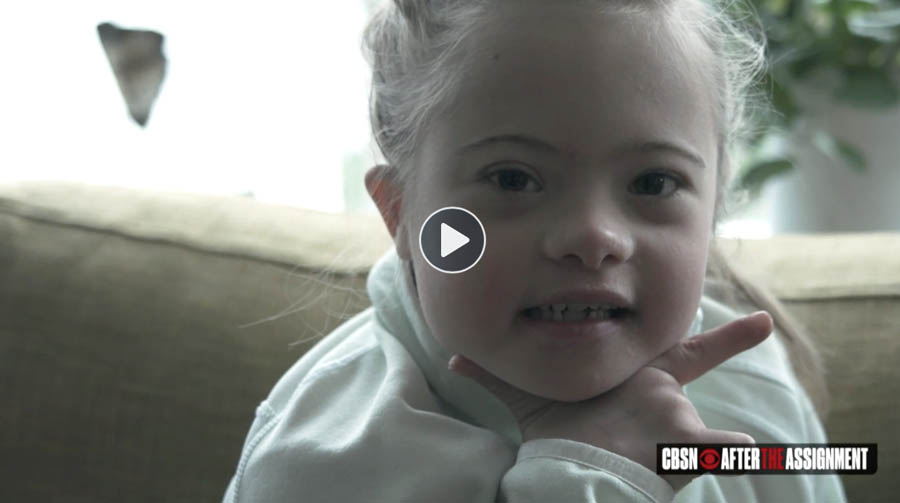 HEARTBEAT PRESIDENT: “Down syndrome is not a death sentence”