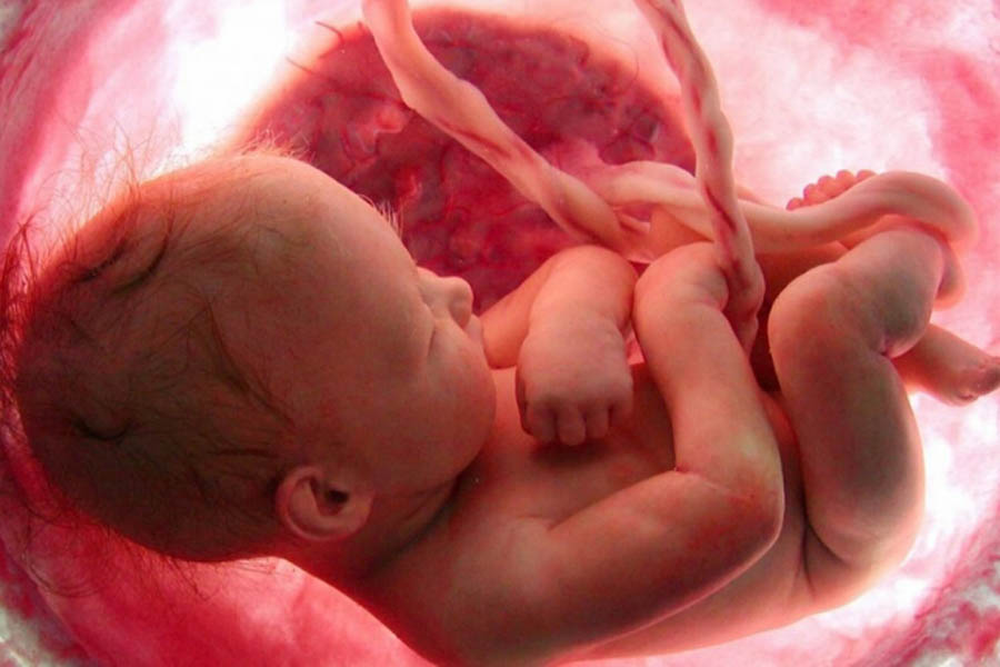 Unborn children may feel pain before 24-week abortion time limit, study finds