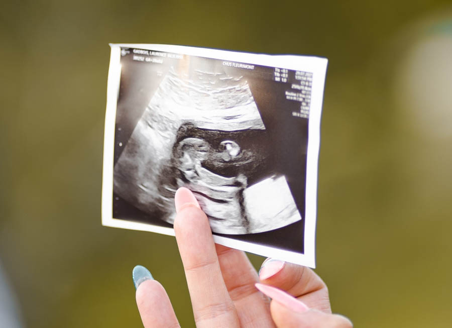 I lost a child to miscarriage. New York Times essay likening miscarriage to abortion is despicable.