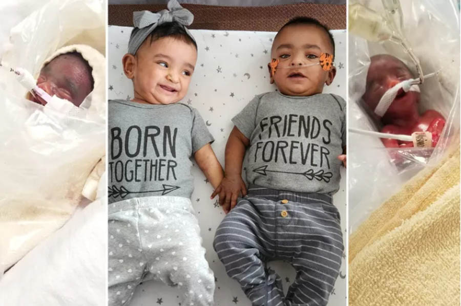 Guinness record holders: Smallest miracle twins born 4 months early defy all odds